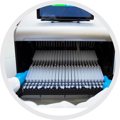 Automated RNA extraction workflow