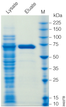 Purification of His-tagged methionyl tRNA synthetase.
